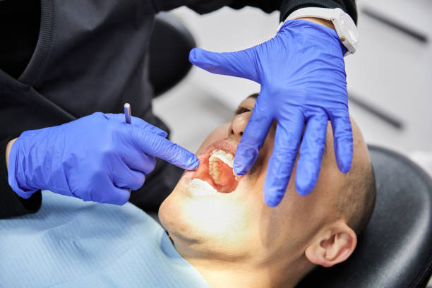 Best Root Canal Emergency Dentist  in Midway, FL